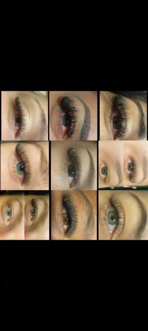 Миглопластика и масажи по домовете София