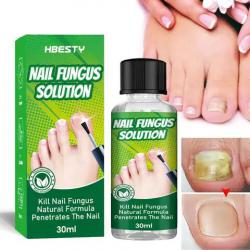 продукт за лечение на гъбички по ноктите